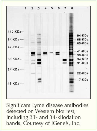 positive lyme negative western blot